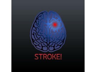 Physiotherapy for Stroke