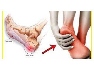 Plantar Fasciitis / Heel Pain