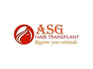 ASG Hair Transplant Centre | Beard Transplant in Ludhiana