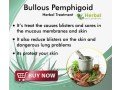 herbal-supplement-for-bullous-pemphigoid-small-0