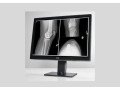 elevate-radiology-practice-with-barcos-premium-display-solutions-small-0
