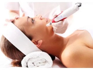 Professional Microneedling Treatment for Acne Scars