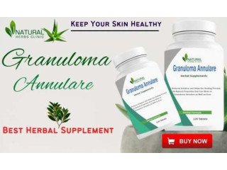 Herbal Supplement for Granuloma Annular