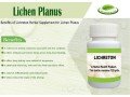 how-you-can-naturally-cure-lichen-planus-small-0