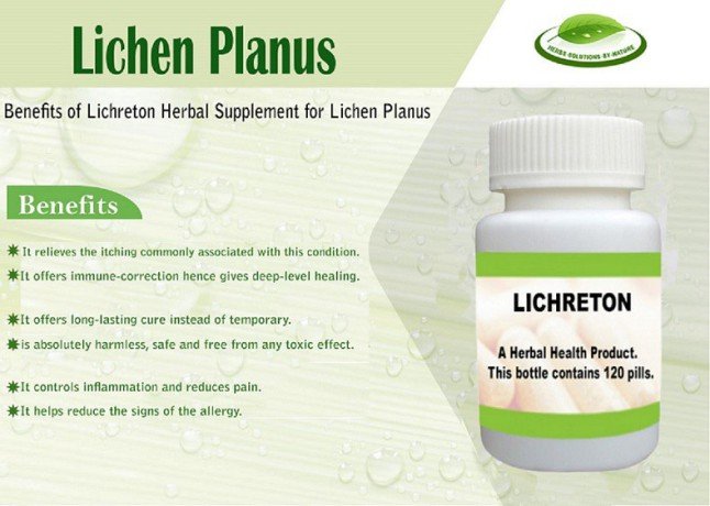 how-you-can-naturally-cure-lichen-planus-big-0