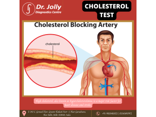 Cholesterol Testing and the Lipid Panel - Dr Jolly Diagnostics